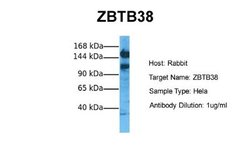 ZBTB38 Antibody, Novus Biologicals 100 &mu;L; Unconjugated:Antibodies,