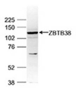 ZBTB38 Rabbit anti-Human, Polyclonal, Novus Biologicals 100 &mu;g | Buy Online | Novus Biologicals | Fisher Scientific