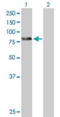 ZBTB39 Antibody, Novus Biologicals 0.05 mg | Buy Online | Novus Biologicals | Fisher Scientific
