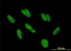 ZBTB48 Antibody, Novus Biologicals 50 &mu;g | Buy Online | Novus Biologicals | Fisher Scientific