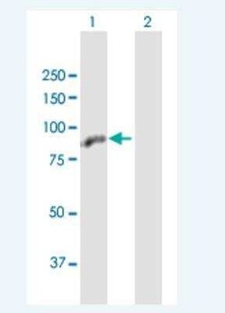 ZBTB48 Antibody, Novus Biologicals 50 &mu;g | Buy Online | Novus Biologicals | Fisher Scientific