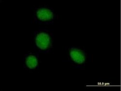 ZBTB6 Antibody, Novus Biologicals 0.05 mg | Buy Online | Novus Biologicals | Fisher Scientific