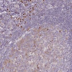 ZBTB6 Antibody, Novus Biologicals 25 &mu;L, Unconjugated:Antibodies, Polyclonal