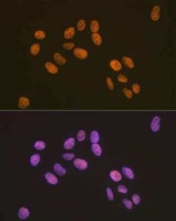 ZBTB7A/Pokemon Rabbit anti-Human, Clone: 3T2J1, Novus Biologicals 100 &mu;g;