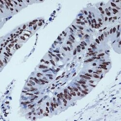ZBTB7A/Pokemon Rabbit anti-Human, Clone: 3T2J1, Novus Biologicals 100 &mu;g;