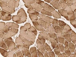 ZC3H12D Antibody, Novus Biologicals 50 &mu;g, Unconjugated:Antibodies,