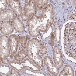 ZC3H13 Antibody, Novus Biologicals:Antibodies:Primary Antibodies