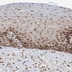 ZC3H13 Antibody, Novus Biologicals:Antibodies:Primary Antibodies