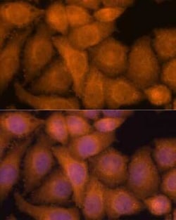 ZC3H7A Antibody - Azide and BSA Free, Novus Biologicals:Antibodies:Primary