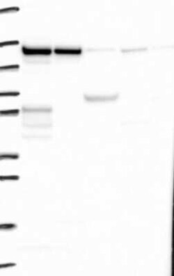 ZC3H7B Rabbit anti-Human, Polyclonal, Novus Biologicals:Antibodies:Primary
