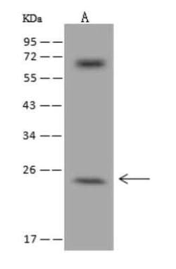 ZCCHC10 Antibody, Novus Biologicals 100 &mu;g | Buy Online | Novus Biologicals | Fisher Scientific
