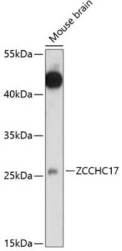 ZCCHC17 Antibody - Azide and BSA Free, Novus Biologicals 0.1 mL; Unconjugated:Antibodies,