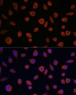 ZCCHC3 Antibody - Azide and BSA Free, Novus Biologicals 0.1 mL; Unconjugated:Antibodies,