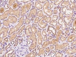ZCCHC4 Antibody, Novus Biologicals:Antibodies:Primary Antibodies