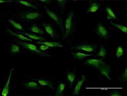 ZCRB1 Antibody, Novus Biologicals 0.05 mg | Buy Online | Novus Biologicals | Fisher Scientific