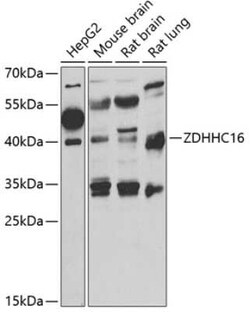ZDHHC16 Antibody - BSA Free, Novus Biologicals 0.1 mL | Buy Online | Novus Biologicals | Fisher Scientific