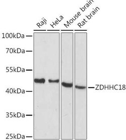 ZDHHC18 Antibody - Azide and BSA Free, Novus Biologicals 0.1 mL; Unconjugated:Antibodies,
