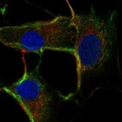 ZDHHC2 Rabbit anti-Human, Polyclonal, Novus Biologicals:Antibodies:Primary