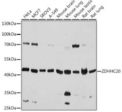 ZDHHC20 Antibody - Azide and BSA Free, Novus Biologicals:Antibodies:Primary
