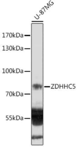 ZDHHC5 Antibody - Azide and BSA Free, Novus Biologicals 0.02 mL | Buy Online | Novus Biologicals | Fisher Scientific