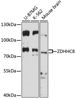 ZDHHC8 Antibody - Azide and BSA Free, Novus Biologicals 0.02 mL, Unconjugated:Antibodies,