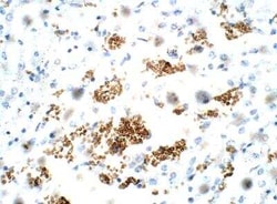 ZDHHC9 Antibody, Novus Biologicals 100 &mu;g | Buy Online | Novus Biologicals | Fisher Scientific