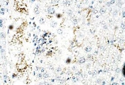 ZDHHC9 Antibody, Novus Biologicals 100 &mu;g | Buy Online | Novus Biologicals | Fisher Scientific