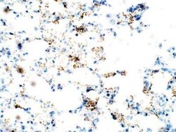 ZDHHC9 Antibody, Novus Biologicals 100 &mu;g | Buy Online | Novus Biologicals | Fisher Scientific