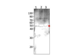 ZDHHC9 Antibody, Novus Biologicals 100 &mu;g | Buy Online | Novus Biologicals | Fisher Scientific