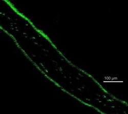 ZEB1 Antibody (2A8A6) - Azide and BSA Free, Novus Biologicals 0.1 mL; Unconjugated:Antibodies,