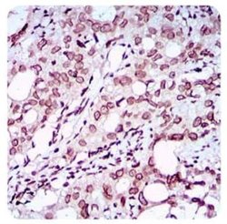 ZEB1 Antibody (2A8A6) - Azide and BSA Free, Novus Biologicals 0.1 mL; Unconjugated:Antibodies,