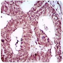 ZEB1 Antibody (2A8A6) - Azide and BSA Free, Novus Biologicals 0.1 mL; Unconjugated:Antibodies,