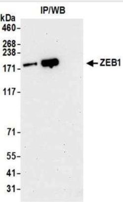 ZEB1 Antibody (BLR102H), Novus Biologicals 100 &mu;g | Buy Online | Novus Biologicals | Fisher Scientific