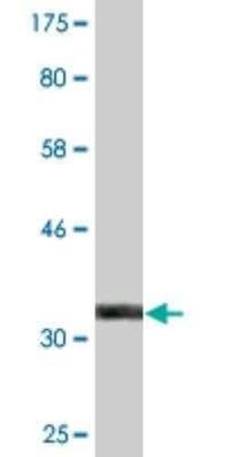 ZFAND3 Antibody (2D2), Novus Biologicals 0.1 mg; Unconjugated:Antibodies,