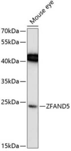 ZFAND5 Antibody - Azide and BSA Free, Novus Biologicals:Antibodies:Primary