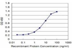 ZBTB14 Antibody (4F7), Novus Biologicals 0.1 mg | Buy Online | Novus Biologicals | Fisher Scientific