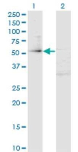 ZBTB14 Antibody (4F7), Novus Biologicals 0.1 mg | Buy Online | Novus Biologicals | Fisher Scientific