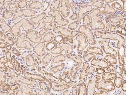 ZFP28 Antibody, Novus Biologicals:Antibodies:Primary Antibodies