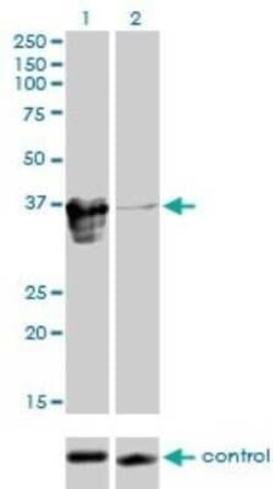 ZFP36L1 Antibody (1A3), Novus Biologicals 0.1 mg | Buy Online | Novus Biologicals | Fisher Scientific