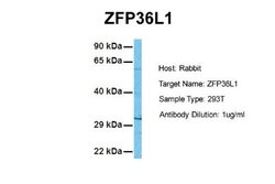 ZFP36L1 Antibody, Novus Biologicals 100 &mu;L | Buy Online | Novus Biologicals | Fisher Scientific