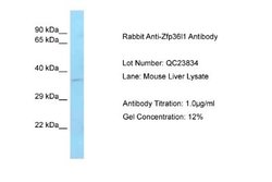 ZFP36L1 Antibody, Novus Biologicals 100 &mu;L; Unconjugated:Antibodies,
