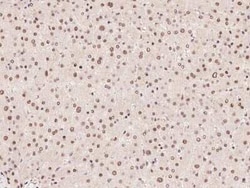ZFP64 Antibody, Novus Biologicals 50 &mu;g, Unconjugated:Antibodies, Polyclonal