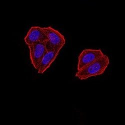 ZFP91 Antibody (7G11H2) - BSA Free, Novus Biologicals 0.1 ml; Unconjugated:Antibodies,