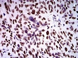 ZFP91 Antibody (7G11H2) - BSA Free, Novus Biologicals 0.1 ml; Unconjugated:Antibodies,