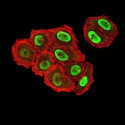 ZFP91 Antibody (8C3D5) - BSA Free, Novus Biologicals 0.1 ml; Unconjugated:Antibodies,