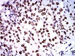 ZFP91 Antibody (8C3D5) - BSA Free, Novus Biologicals 0.1 ml; Unconjugated:Antibodies,