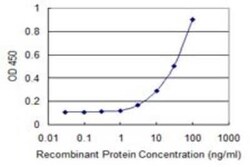 ZFYVE16 Antibody (2E2), Novus Biologicals 0.1 mg | Buy Online | Novus Biologicals | Fisher Scientific