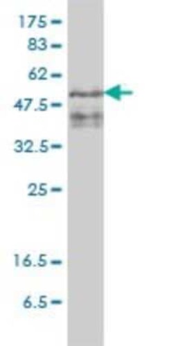 ZFYVE19 Antibody (4D5-2D11), Novus Biologicals 0.1 mg; Unconjugated:Antibodies,