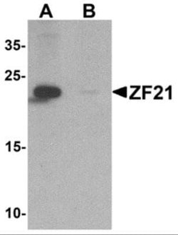 ZFYVE21 Antibody - BSA Free, Novus Biologicals 0.1 mg | Buy Online | Novus Biologicals | Fisher Scientific