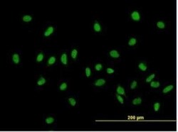 ZHX1 Antibody, Novus Biologicals 50 &mu;g | Buy Online | Novus Biologicals | Fisher Scientific